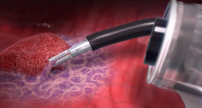 DiLumen-C2_1_800a DiLumen-C2_1_800a